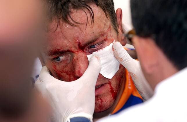 Marc Lotz (Niederlande Rabobank) wird nach seinem schweren Sturz medizinisch versorgt Radsport Herren Tour de France 2003, Straßenradsport, Straße, Rad, Einzelbild 1. Etappe: Saint Denis Montgeron - Meaux