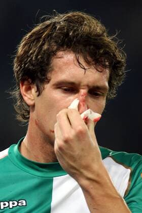 Frank Baumann (Bremen) mit blutiger Nase -  Fußball EC 1 Herren Champions League 2007 2008, SV Werder Bremen Porträt Rom Fußball EC 1 Herren Champions League 2007 2008, SV Werder Bremen Porträt Rom