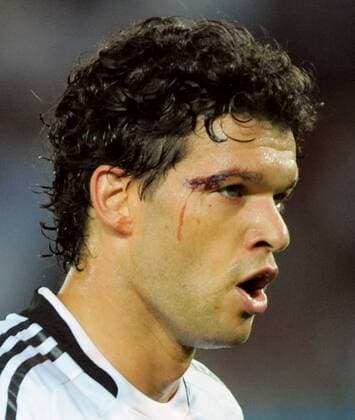 Michael Ballack (Deutschland) hat sich nach einem Zusammenprall an der Schläfe verletzt Fußball EM Herren EURO 2008, Finale, Nationalteam, Nationaltrikot, Porträt Wien