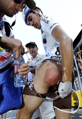 Lloyd Mondory (AG2R) nach einem Sturz , Rotterdam Brüssel XPHOTOXNEWSX  o0 zerrissen Schürfwunde Wunde Po Gesäß Hintern Symbol