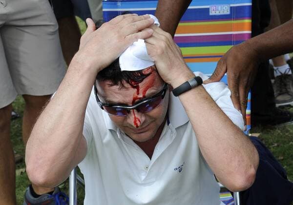 09 March 2014: A fan tries to stop the bleeding from his head after being hit by Tiger Woods tee shot from first tee box during the final round of the World Golf Championships-Cadillac Championship on the Blue Monster course at the Trump National Doral in Doral, FL. GOLF: MAR 09 PGA Golf Herren - World Golf Championships-Cadillac Championship - Final Round Icon20180945 EDITORIAL USE ONLY