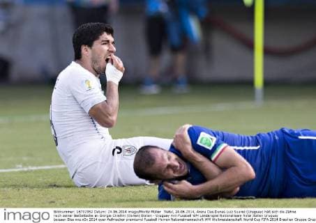 IMAGO Iconic Moments, Fußball Natal, 24.06.2014, Arena Das Dunas Luiz Suarez (Uruguay) hält sich die Zähne nach seiner Beißattacke an Giorgio Chiellini (Italien) Italien - Uruguay mm