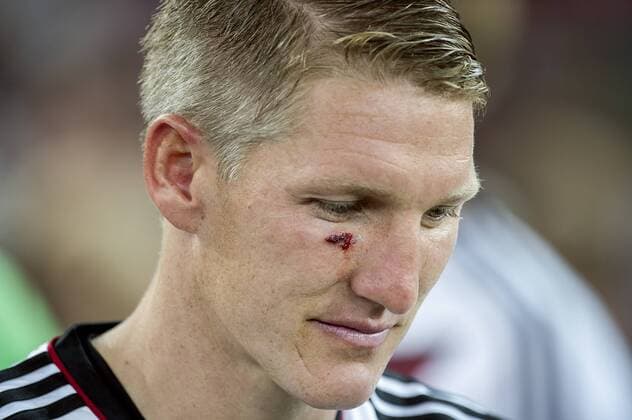 Bastian SCHWEINSTEIGER (GER), Portrait, Porträt, Porträt, Solo, Einzel, Einzeln, Kopf mit Verletzung unter dem rechten Auge, blutend, cut, Deutschland (GER) - Argentinien (ARG) 1:0 nach Verlängerung, Finale, Spiel 64, am 13.07.2014 in Rio de Janeiro; Deutschland ist Weltmeister Fussball Weltmeisterschaft 2014 in Brasilien vom 12.06. - 13.07.2014.