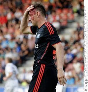 Hamburger SV Testspiel in Kassel 1. Fussball Bundesliga Saison 2015-2016 Hamburger SV Testspiel am 24.07.2015 in Kassel KSV Hessen Kassel - Hamburger SV Ivica Olic (Hamburger SV) verletzt