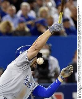 Oct. 19, 2015 - Toronto, CAN - Kansas City Royals first baseman Eric Hosmer had a bloodied lip after he got smacked in the mouth by a foul ball he hit during the fifth inning on Monday, Oct. 19, 2015, at Rogers Centre in Toronto. Kansas City Royals at Toronto Blue Jays - ZUMAm67_