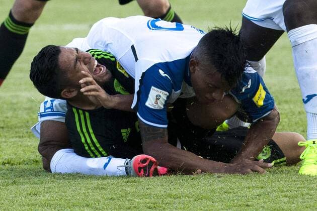 SAN PEDRO SULA, Nov. 17, 2015 -- Honduras Luis Garrido (R) is injured during vying with Mexico s Javier Aquino at a Group A football match in round 4 of the 2018 FIFA World Cup WM Weltmeisterschaft Fussball qualification preliminaries against Honduras in San Pedro Sula, Honduras, Nov. 17, 2015. Mexico won the game 2-0. ) (jp) (sp) (SP)HONDURAS-SAN PEDRO SULA-SOCCER-HONDURAS VS MEXICO RAFAELxOCHOA 