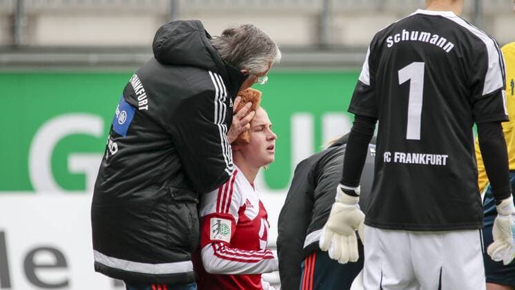 Fußball, Allianz Frauen Bundesliga, VfL Wolfsburg - 1. FFC Frankfurt; Ana-Maria Crnogorcevic (Frankfurt, 21) Verletzt, am Boden, behandelt, injury, injured, hurt. xtgx