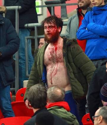 England v Scotland - FIFA World Cup WM Weltmeisterschaft Fussball 2018 Qualifier . . London, UK . . 11.11.2016 Fighting broke out amongst some England supporters, leaving one man covered in blood. 