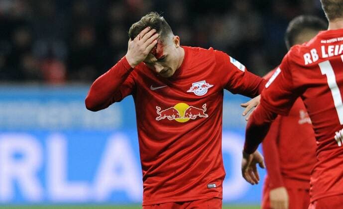 Fussball, Bundesliga, Deutschland, Herren, Saison 2016 2017, 11. Spieltag, BayArena Leverkusen, Bayer Leverkusen (schwarz) - RB Leipzig (rot); Marcel Sabitzer (Leipzig) mit offener Platzwunde am Kopf nach dem Zusammenprall mit Wendell (Leverkusen). Verletzung, Schmerz, Schmerzen.