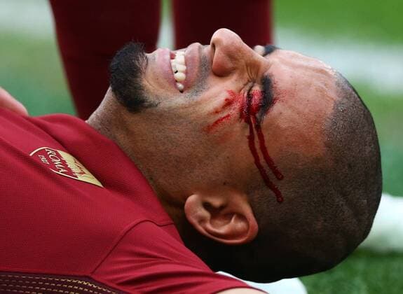 Themen der Woche - SPORT Bilder des Tages - SPORT December 4, 2016 - Rome, Italy - Bruno Peres of AS Roma hurt after a strong tackle by Senad Lulic of SS Lazio during the Italian Serie A football match between S.S. Lazio and A.S. Roma at the Olympic Stadium in Rome, on december 04, 2016. SS Lazio v AS Roma - Serie A  - ZUMAn230 20161204_zaa_n230_206