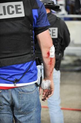 Fußball, EL, Olympique Lyon - Besiktas Istanbul, Ausschreitungen vor Spielbeginn ILLUSTRATION - SUPPORTERS - INCIDENTS - SECURITE - POLICE - BLESSURE FOOTBALL : Lyon vs Besiktas - Europa League - 13 04 2017 FEP Panoramic 