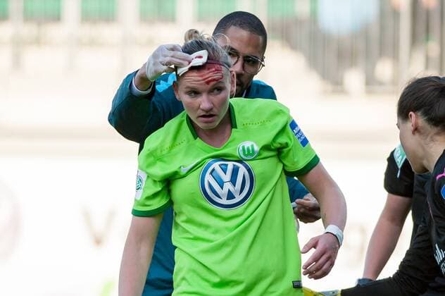 v.li.: Alexandra Popp (VfL Wolfsburg, 11) hat eine blutende Wunde, Platzwunde am Kopf, Blut, Verletzung, Schmerzen, schmerzverzerrtes Gesicht, Fussball, Allianz Frauen-Bundesliga, VfL Wolfsburg - SGS Essen, xobx