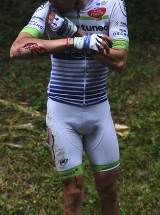 Themen der Woche Bilder des Tages - SPORT Tour de France, 9. Etappe, Eduardo Sepulveda nach Sturz mit klaffender Wunde am Arm Chute Blessure : SEPULVEDA Eduardo of Fortuneo - Vital Concept CYCLISME : Tour de France 2017 - Etape 9 - Nantua a Chambery - 09 07 2017 PhotoNews Panoramic 