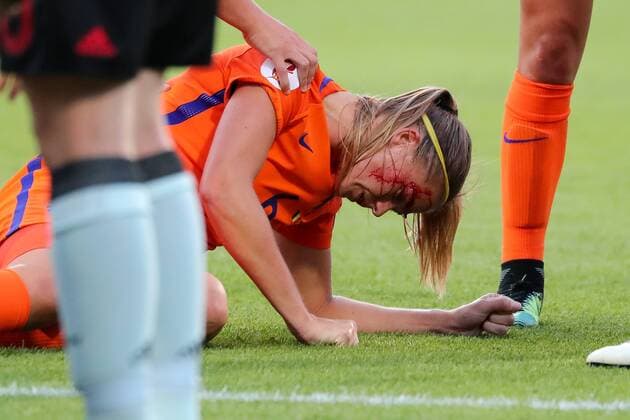 Themen der Woche - SPORT Themen der Woche - SPORT Bilder des Tages - SPORT Fußball, Frauen EM, Belgien - Niederlande Anouk Dekker (Holland, 6) liegt mit einer blutenden Platzwunde auf dem Feld, kann aber weiterspielen, verletzt, Verletzung, injured, sporting injury, Fussball, UEFA Women s EURO 2017, Belgien - Niederlande, xozx