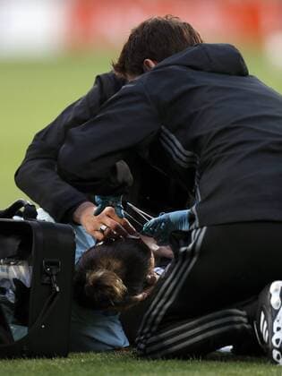 Fußball, Frauen EM, Belgien - Niederlande Doctors attach head wound of Maud Coutereels of Belgium women during the UEFA WEURO 2017 Group A group stage match between Belgium and The Netherlands at Koning Willem II stadium on July 24, 2017 in Tilburg, The Netherlands Women: Belgium v The Netherlands UEFA WEURO 2017 2017 2018 xVIxVIxImagesx xMauricexvanxSteenxIVx 8305267