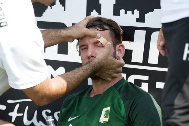 Bilder des Tages - SPORT Chemie-Kapitän Stefan Karau wird mit einer Kopfverletzung behandelt. Fußball-Regionalliga Nordost 2017 2018, 5. Spieltag - BSG Chemie Leipzig vs. Union Fürstenwalde Leipzig Sachsen Deutschland