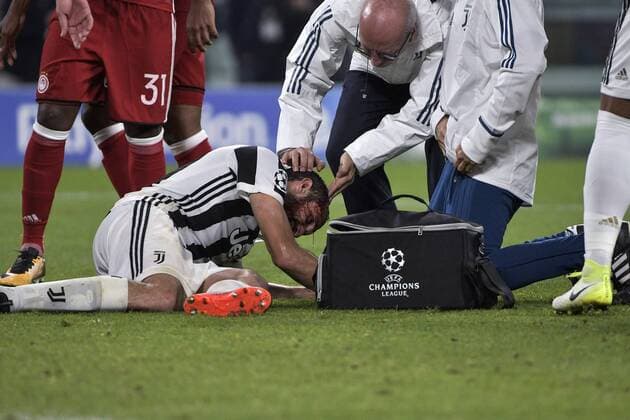 Giorgio Chiellini infortunio Injured Torino 27-09-2017 Allianz Stadium Football Champions League 2017 2018 Juventus - Olympiacos Foto Image Insidefoto oneplusnine