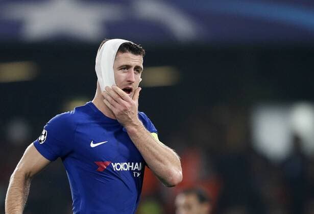 Themen der Woche - SPORT Bilder des Tages - SPORT Fußball, CL, FC Chelsea - AS Rom Chelsea s Gary Cahill gets an injury to his head during the champions league group match at Stamford Bridge Stadium, London. Picture date 18th October 2017. Picture credit should read: David Klein Sportimage EDITORIAL USE ONLY. No use with unauthorised audio, video, data, fixture lists, club league logos or live services. Online in-match use limited to 120 images, no video emulation. No use in betting, games or single club league player publications.