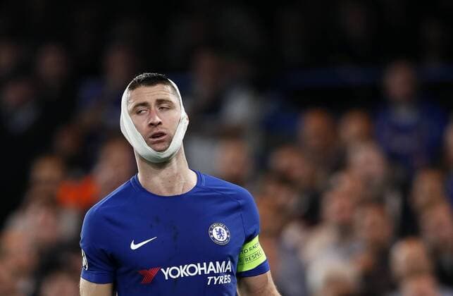Chelsea s Gary Cahill gets an injury to his head during the champions league group match at Stamford Bridge Stadium, London. Picture date 18th October 2017. Picture credit should read: David Klein Sportimage EDITORIAL USE ONLY. No use with unauthorised audio, video, data, fixture lists, club league logos or live services. Online in-match use limited to 120 images, no video emulation. No use in betting, games or single club league player publications.
