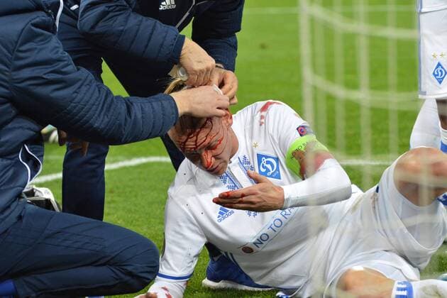 Domagoj Vida breaks his head in the match with BSC Young Boys Kyiv  Copyright: HusevxOleksandr 511089