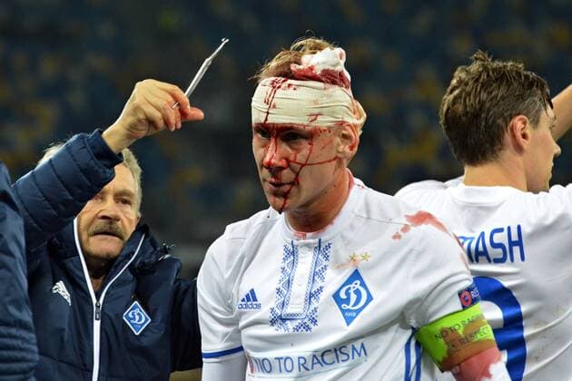 Domagoj Vida breaks his head in the match with BSC Young Boys Kyiv  Copyright: HusevxOleksandr 511094