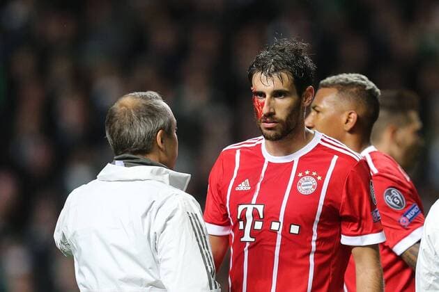 Team doctor Dr Volker Braun FC Bayern Muenchen treats Javi Martinez 8 FC Bayern Muenchen am Auge Blood Celtic Glasgow vs FC Bayern Muenchen Football Preliminary Round Champions League 31 10 2017 Glasgow Glasgow Scotland Copyright: xkolbert-press ChristianxKolbertx