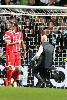 Javier Martinez FC Bayern Muenchen 8 after the 1 2 with a laceration on the head Celtic Glasgow vs Bayern Munich Champions League Football 31 10 2017 Glasgow Copyright: xLanger Eibner-Pressefotox EP_HLR