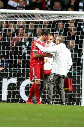 Javier Martinez FC Bayern Muenchen 8 after the 1 2 with a laceration on the head Celtic Glasgow vs Bayern Munich Champions League Football 31 10 2017 Glasgow Copyright: xLanger Eibner-Pressefotox EP_HLR