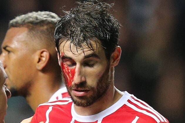 Team doctor Dr Volker Braun FC Bayern Muenchen treats Javi Martinez 8 FC Bayern Muenchen am Auge Blood Celtic Glasgow vs FC Bayern Muenchen Football Preliminary Round Champions League 31 10 2017 Glasgow Glasgow Scotland Copyright: xkolbert-press ChristianxKolbertx