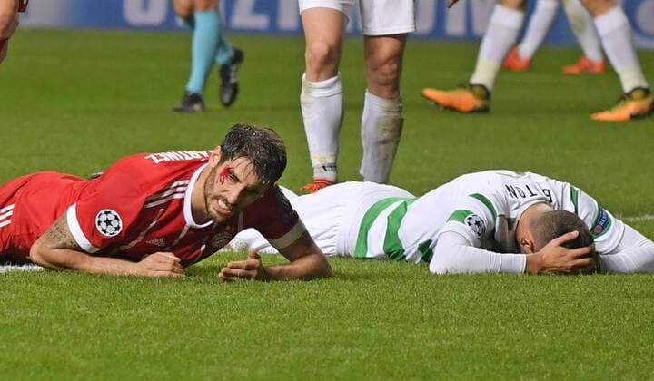 31 10 2017 Football UEFA Champions League 2017 2018 Group stage 4 Gameday Celtic Glasgow FC Bayern Munich in Celtic Park Stadium Glasgow Scotland After scoring on goalkeeper Javi Martinez left Bayern Munich on the ground with a bleeding head injury