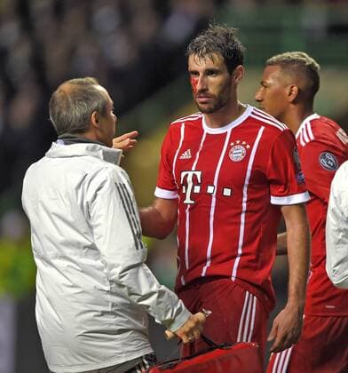 31 10 2017 Football UEFA Champions League 2017 2018 Group stage 4 Gameday Celtic Glasgow FC Bayern Munich at Celtic Park Stadium Glasgow Scotland After scoring on goalkeeper Javi Martinez re FC Bayern Munich will face a bleeding head injury