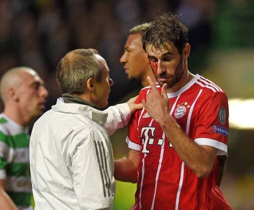 31 10 2017 Football UEFA Champions League 2017 2018 Group stage 4 Gameday Celtic Glasgow FC Bayern Munich at Celtic Park Stadium Glasgow Scotland After scoring on goalkeeper Javi Martinez re FC Bayern Munich will face a bleeding head injury