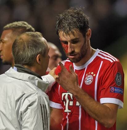 31 10 2017 Football UEFA Champions League 2017 2018 Group stage 4 Gameday Celtic Glasgow FC Bayern Munich at Celtic Park Stadium Glasgow Scotland After scoring on goalkeeper Javi Martinez re FC Bayern Munich will face a bleeding head injury