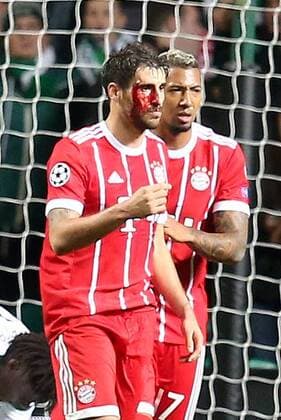 Javier Martinez FC Bayern Muenchen 8 after the 1 2 with a laceration on the head Jerome Boateng FC Bayern Muenchen 17 Celtic Glasgow vs Bayern Munich Champions League Football 31 10 2017 Glasgow Copyright: xLanger Eibner-Pressefotox EP_HLR