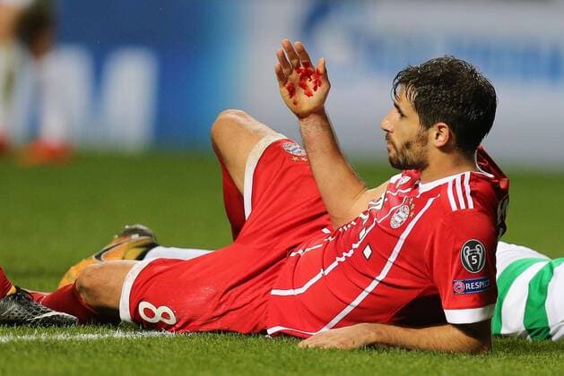 Javi Martinez 8 Bayern Munich injured in the eye on the ground Celtic Glasgow vs Bayern Munich Football Preliminary Round Champions League 31 10 2017 Glasgow Glasgow Scotland Copyright: xkolbert-press ChristianxKolbertx