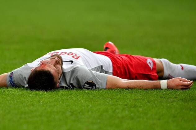 SOCCER - EL, RBS vs Vitoria SALZBURG,AUSTRIA,23.NOV.17 - SOCCER - UEFA Europa League, Red Bull Salzburg vs Vitoria Guimaraes SC. Image shows Valon Berisha (RBS). Keywords: injury, blood. GEPAxpictures xFlorianxErtl