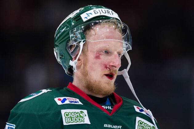 Themen der Woche - SPORT Bilder des Tages - SPORT 180130 Frölundas Simon Hjalmarsson lämnar isen med skada i ansiktet under ishockeymatchen i SHL mellan Frölunda och Djurgarden den 30 januari 2018 i Göteborg. *** 180130 Frölunda s Simon hjalmarsson leaving the ice with damage in the face during the ice hockey match in the SHL between Frölunda and Animal garden on 30 January 2018 in Gothenburg  Copyright: MICHAELxERICHSEN BB180130MI058