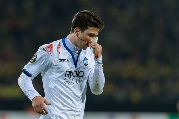 Dortmund Germany 15 02 2018 UEFA Europa League 2017 18 Season Sechzehntelfinale Mattia Caldara Bergamo injured DeFodi001