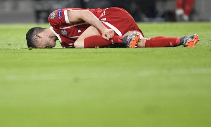 Robert Lewandowski Bayern Munich injury infringed FC Bayern Munich FCB vs Sevilla FC UEFA Champions League CL quarter-final second leg match 2 Season 2017 2018 Munich Allianz Arena 11 04 2018 FC Bayern Munich FCB vs Sevilla FC