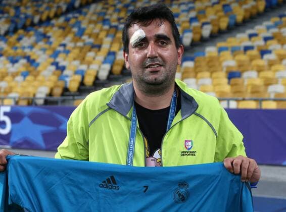 Bilder des Tages - SPORT Real Madrid Training Spanish cameraman Lorenzana Prieto of Univision Deportes Network (USA) had his camera hit by a wild shot from Cristiano Ronaldo of Real Madrid which in turn hit him in the face causing a deep cut over his right eye. The Real Madrid star then sent his training top via a member of the backrooom team over to Lorenzana and waved an apology during the Real Madrid training session at the Olympic Stadium, Kiev Content Not Available For UK Newspapers Copyright: xPaulxChestertonx FIL-11836-0012