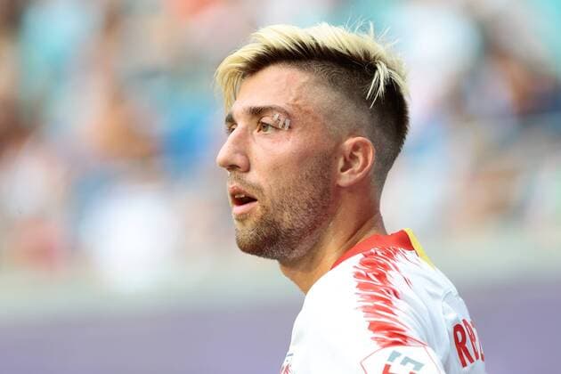09 08 2018 xtgx Soccer Europa League 3 Qualifying Round RB Leipzig CS Universitatea Craiova emspor v Kevin Kampl Leipzig 44 with a lacerated wound on his left eye Portrait Portrait Single Picture Leipzig