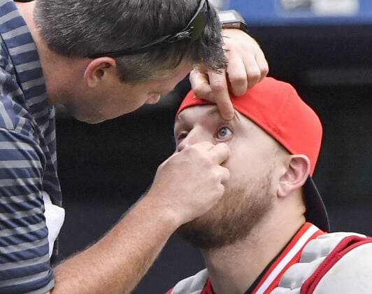 August 26, 2018 - Kansas City, MO, USA - Cleveland Indians catcher Roberto Perez gets his eye checked and flushed for dirt in the first inning against the Kansas City Royals on Sunday, Aug. 26, 2018, at Kauffman Stadium in Kansas City, Mo. Cleveland at Kansas City - ZUMAm67_ 20180826_zaf_m67_010 Copyright: xJohnxSleezerx