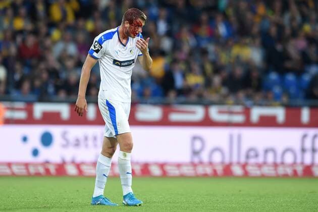 Sport Themen der Woche KW37 Sport Bilder des Tages Fußball 3. Liga 07. Spieltag Eintracht Braunschweig - Carl Zeiss Jena am 14.09.2018 im Eintracht-Stadion in Braunschweig Marius Grösch Groesch (Jena) verlässt blutend das Feld. *** Soccer 3 Liga 07 Match Eintracht Braunschweig Carl Zeiss Jena on 14 09 2018 at the Eintracht Stadium in Braunschweig Marius Groesch Jena leaves the field bleeding MT