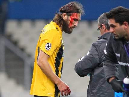Sport Bilder des Tages AEK Athens v Ajax Amsterdam UEFA Champions League Dmytro Chygrynskiy of AEK Athens face is covered in blood during the UEFA Champions League match at Olympic Stadium, Athens Content Not Available For UK Newspapers Copyright: xYannisxHalasx FIL-12606-0037