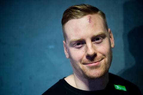 190110 Henrik Jakobsen of Norway with a scar in his forehead during a media event on January 10 2019 in Herning Photo Jon Olav Nesvold BILDBYR u0081N kod JE 160391, detectedSourceLanguage  Copyright: JONxOLAVxNESVOLD BB190110JE019