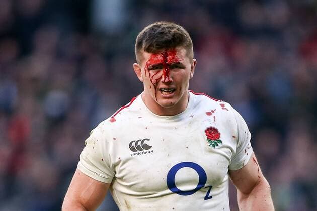 Sport Themen der Woche KW06 Sport Bilder des Tages England v France Guinness 6 Nations Tom Curry of England receives a head injury during the Guinness 6 Nations match at Twickenham Stadium, Twickenham Content Not Available For UK Newspapers Copyright: xMarkxChappellx FIL-12880-0009