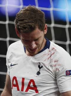 Jan Vertonghen of Tottenham injured during the UEFA Champions League match at the Tottenham Hotspur Stadium, London. Picture date: 30th April 2019. Picture credit should read: David Klein Sportimage EDITORIAL USE ONLY. No use with unauthorised audio, video, data, fixture lists, club league logos or live services. Online in-match use limited to 120 images, no video emulation. No use in betting, games or single club league player publications. SPI-0063-0066