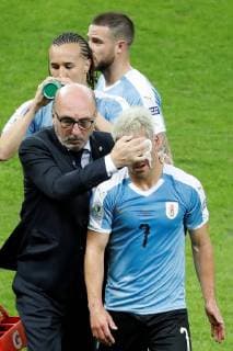 Uruguayan Nicolas Lodeiro (R) receives medical assistance during the Copa America 2019 Group C soccer match between Uruguay and Ecuador, at Mineirao Stadium in Bello Horizonte, Brazil, 16 June 2019. Uruguay vs. Ecuador !ACHTUNG: NUR REDAKTIONELLE NUTZUNG!  Copyright: xPauloxFonsecax SCA0543 20190617-636963294306071346