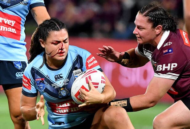Bilder des Jahres 2020, Sport 11 November Sport Themen der Woche KW46 Sport Bilder des Tages WOMENS STATE OF ORIGIN, Millie Boyle (left) of NSW is seen bleeding from an injury during the Women s State of Origin Rugby League match between the Queensland Maroons and the New South Wales Women at Sunshine Coast Stadium on the Sunshine Coast, Friday, November 13, 2020. ( NO ARCHIVING, EDITORIAL USE ONLY, NO USE IN BOOKS WITHOUT CONSENT SUNSHINE COAST QLD AUSTRALIA  Copyright: xDARRENxENGLANDx 20201114001503227072