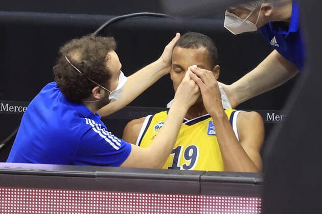 GER, BBL, ALBA Berlin vs Jobstairs Giessen 46ers 10 01 2021, Mercedes Benz Arena, Berlin, GER, BBL, ALBA Berlin vs Jobstairs Giessen 46ers, in picture Louis Olinde ALBA Berlin 19 , eye injured nordphotoxEngler nph00076